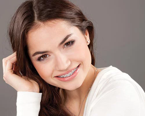 Как брекеты меняют лицо