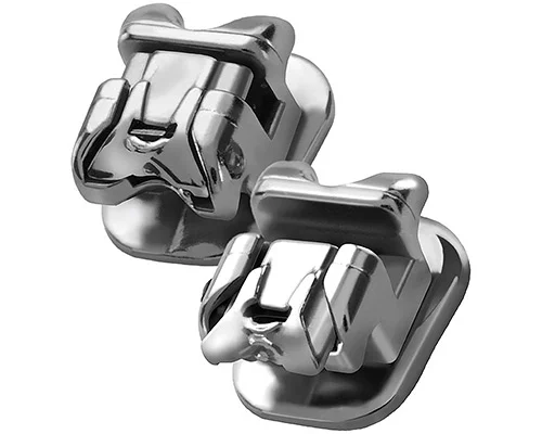 Как работают брекеты