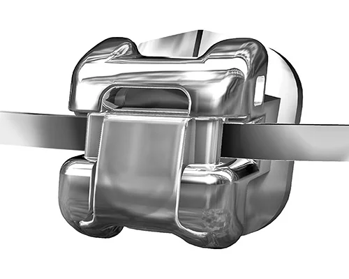 Сколько стоят брекеты