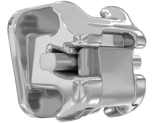 Торки брекетов