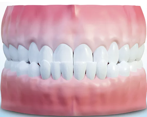 Мезиальный прикус